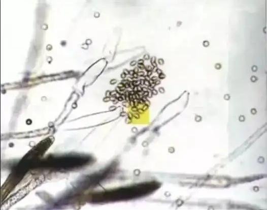 12月，水产养殖户需谨防这些疾病！