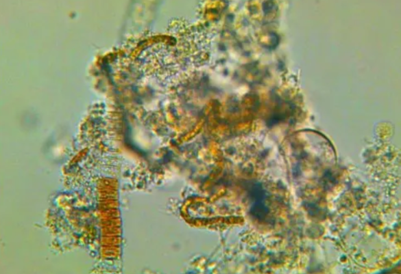 高密度的循环水养殖，需要监测哪些水质指标？