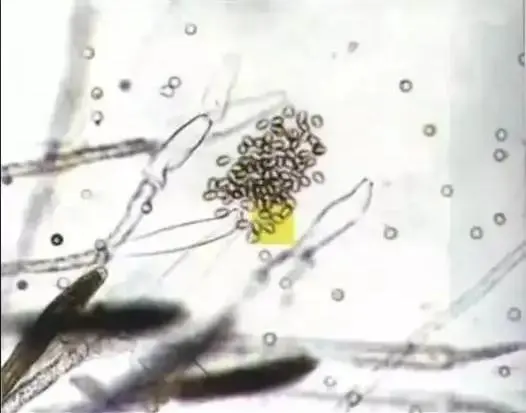 低温来袭，鱼体“长毛”？这份水霉病防控指南请收藏！